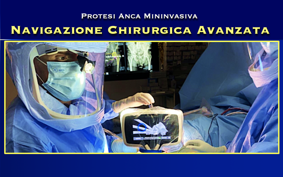 Protesi d’anca con Navigazione chirurgica avanzata