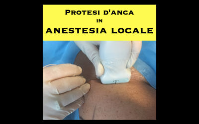 Protesi d’anca in anestesia locale